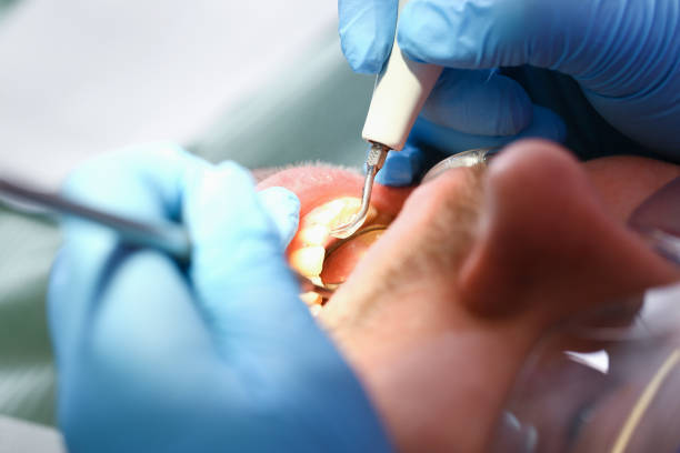 Best Pediatric Emergency Dentist in Magna, UT
